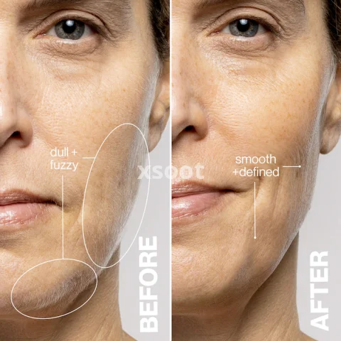 LUXE+ Advanced Sonic Dermaplaning + Peach Fuzz Removal