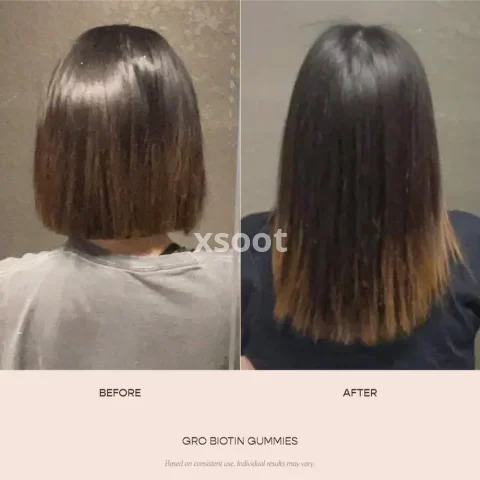 GRO Biotin Gummies for Thinning Hair